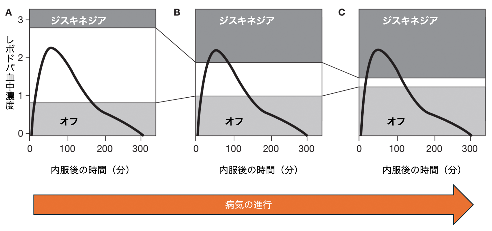 デバイス補助治療（Device Aided Therapy; DAT）とは？